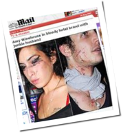 Amy Winehouse: Blutige Prügelei mit Ehemann