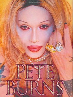 Dead Or Alive: Sänger Pete Burns ist tot