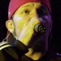 Limp Bizkit - Redcap nackt im Netz